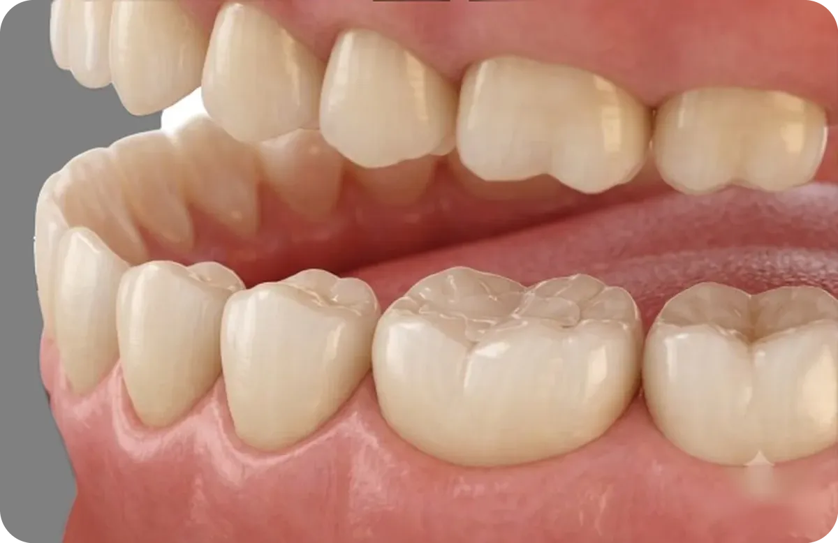 cosmetic-fillings hero image